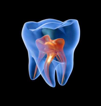 Desvitalizações Dentárias